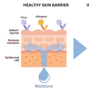 When your barrier is stressed, symptoms may include dryness, tightness, flaking, redness, inflammation, increased sensitivity, acne breakouts, eczema flare-ups, infections, and even hyperpigmentation. If you notice persistent irritation or dullness, your skin barrier may be weakened.