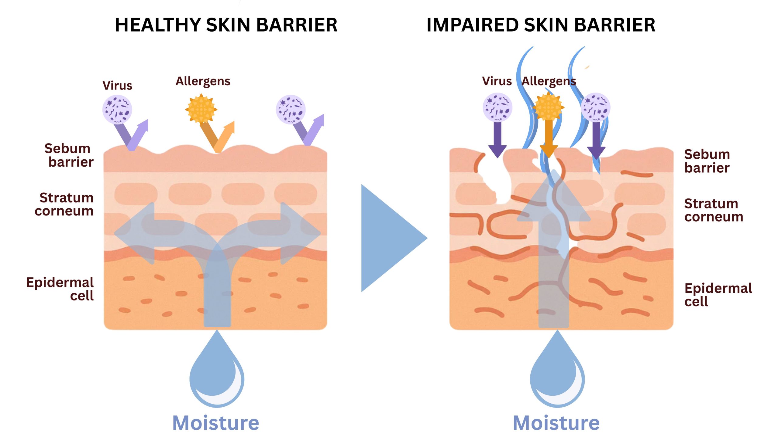 When your barrier is stressed, symptoms may include dryness, tightness, flaking, redness, inflammation, increased sensitivity, acne breakouts, eczema flare-ups, infections, and even hyperpigmentation. If you notice persistent irritation or dullness, your skin barrier may be weakened.
